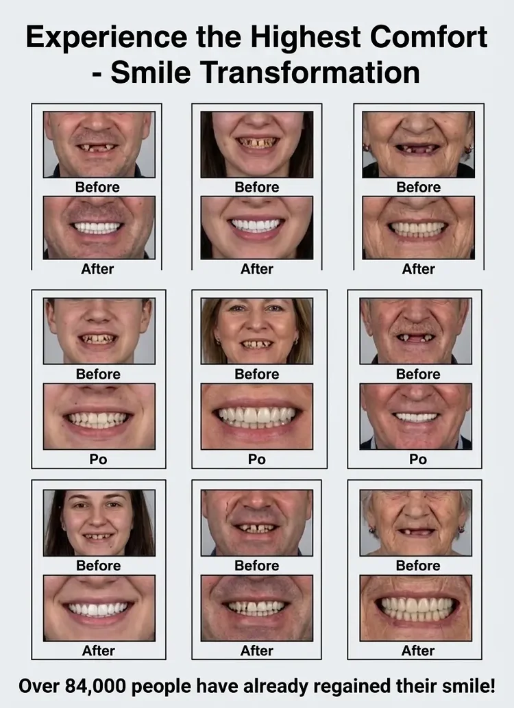 🏆2026 Best Seller |Custom-Fit Dentures ⏰ ENDS TODAY   50% OFF | Smile with Confidence