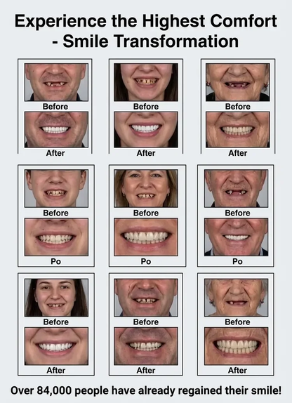 🏆2026 Best Seller |Custom-Fit Dentures ⏰ ENDS TODAY   50% OFF | Smile with Confidence