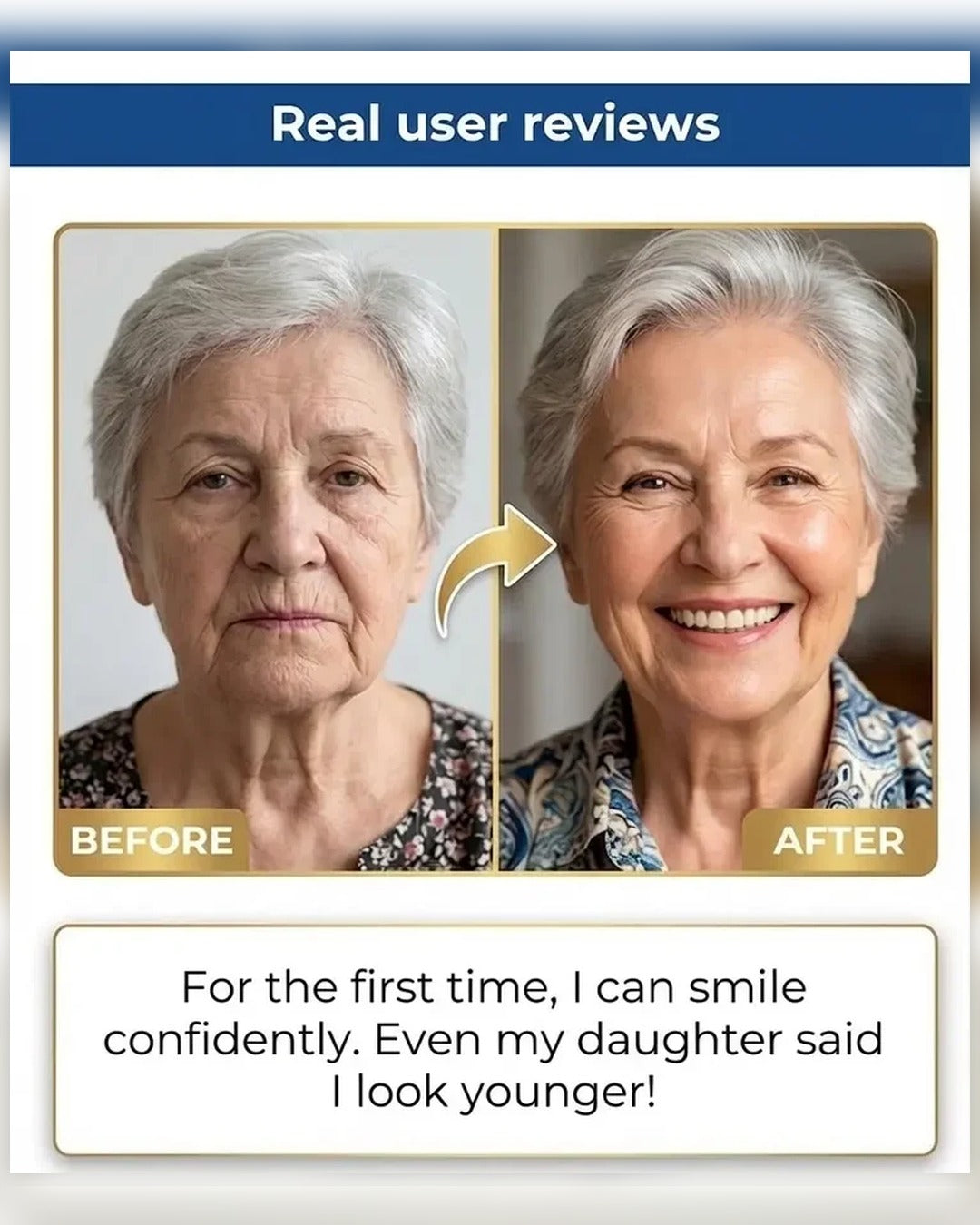 🏆2026 Best Seller |Custom-Fit Dentures ⏰ ENDS TODAY   50% OFF | Smile with Confidence