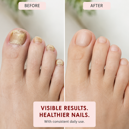 🏆Ends Today: 70% OFF! 🏆2026 Best Seller |Multi-Purpose Nail Repair